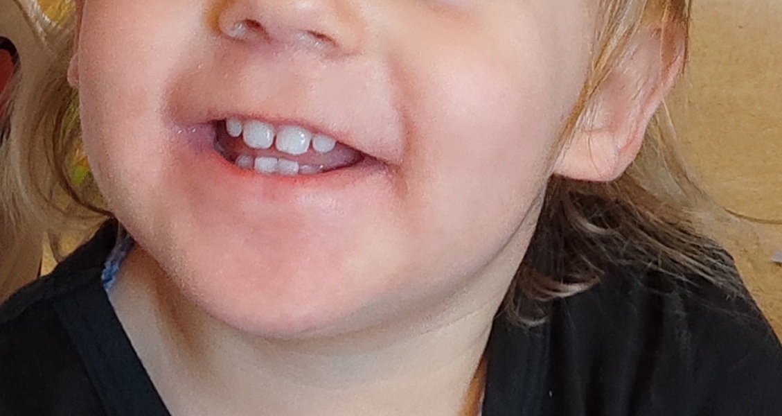 Toddler rash help. Desperate mum here