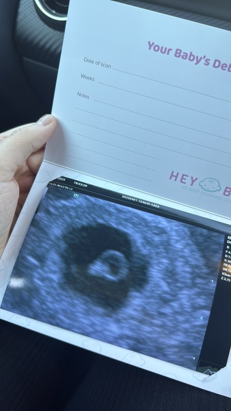 Guess my babies gender according to ramzi theory?