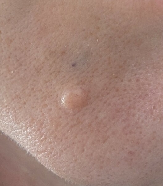 Weird thing on chin - what think?