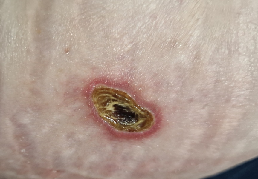 Random raw skin thing - ideas?