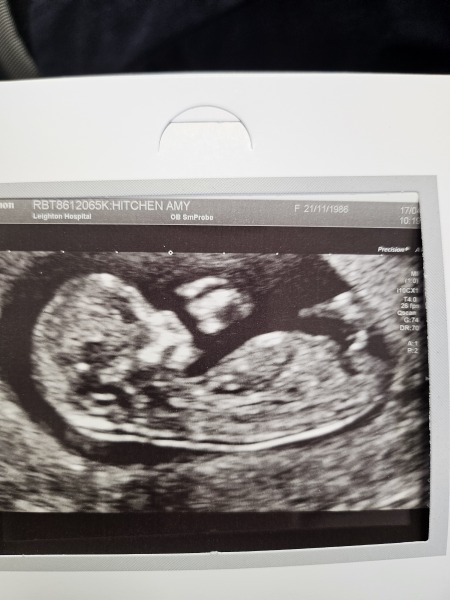 Boy or Girl