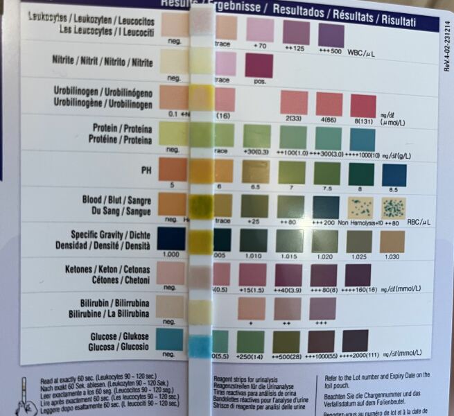 Urine test