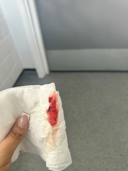 Missed pills & spotting