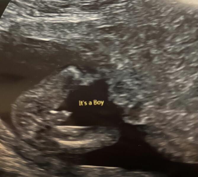 Is this a boy on scan photo?