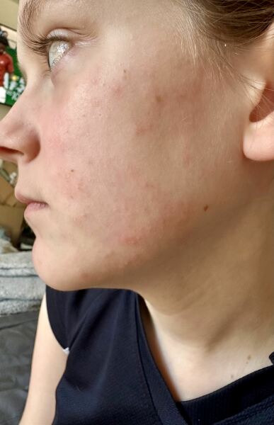 Phone call from school; they’re ’not medically trained’ ?!