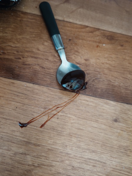 Inflammatory Arthritis /any AI chat thread.