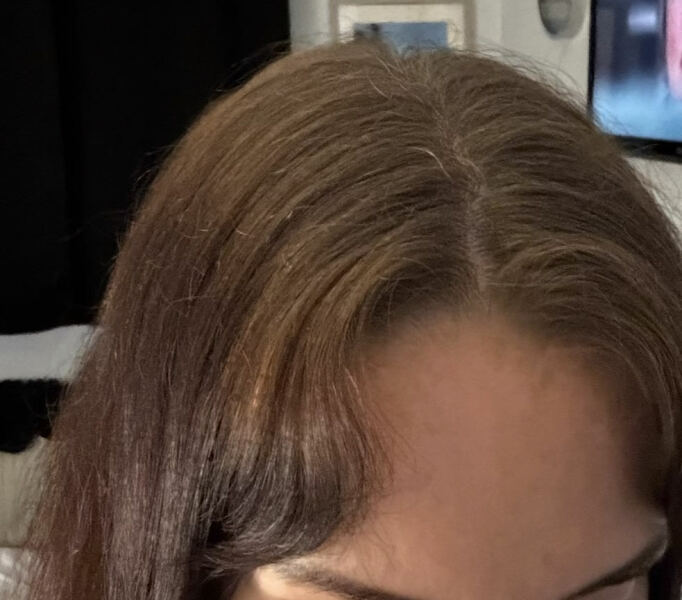 Hair growth - pic included