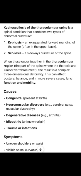 Is this scoliosis ? DD 17