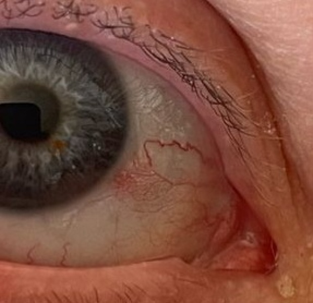 Weird red eye help!!