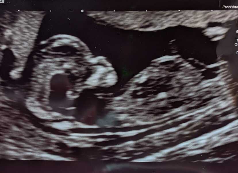 Girl or boy? Thoughts please :)