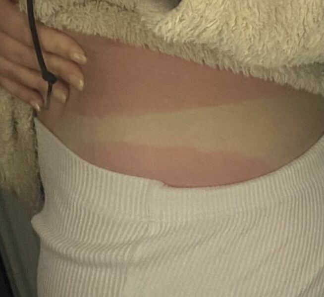 Sunbed Shock