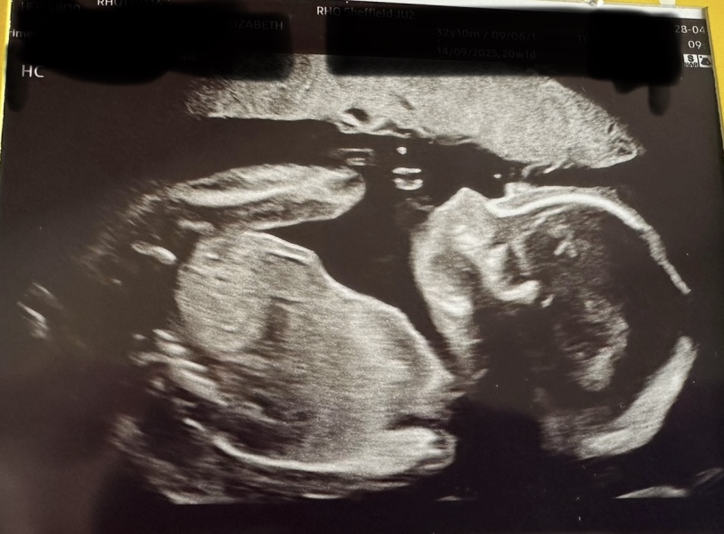 Gender guesses please !