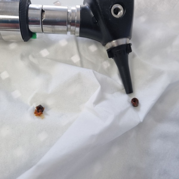 Ear wax!