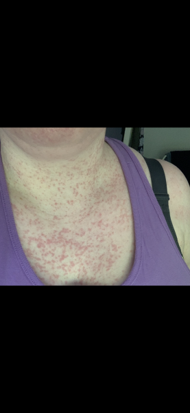 Phone call from school; they’re ’not medically trained’ ?!