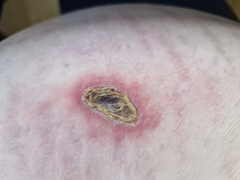 Random raw skin thing - ideas?