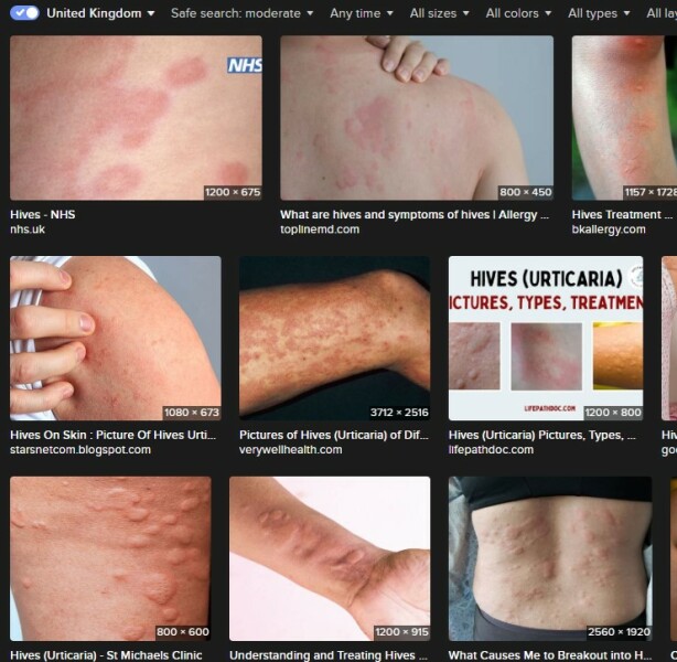 Phone call from school; they’re ’not medically trained’ ?!