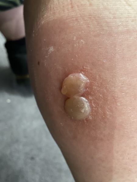 Worst reasons collegues have rang in sick....