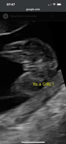 20 week potty shot - boy or girl?