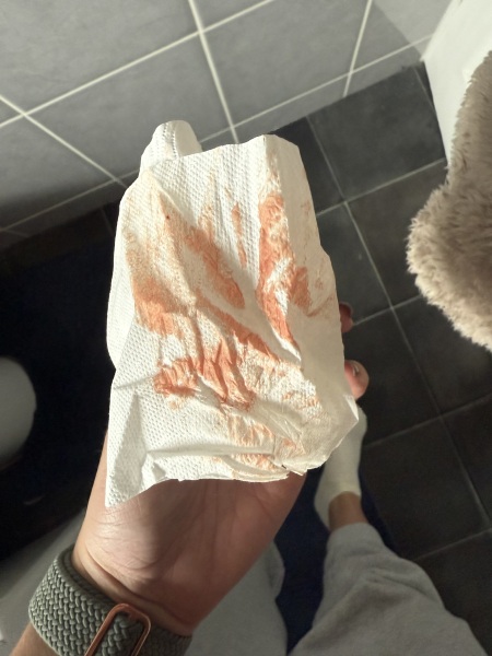 Went to EPAU yesterday for a scan, pregnancy viable, now bleeding heavily