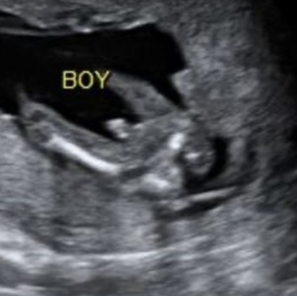 15 week private scan