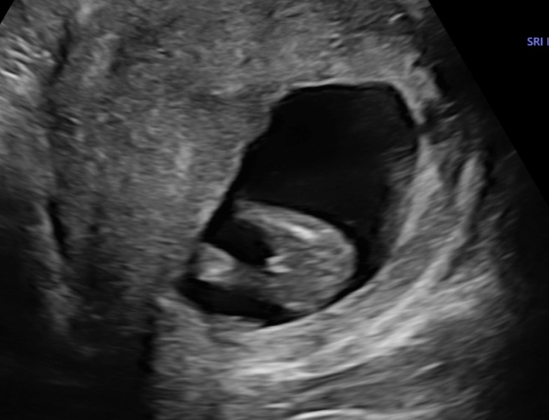 Potty shot - is this a boy?