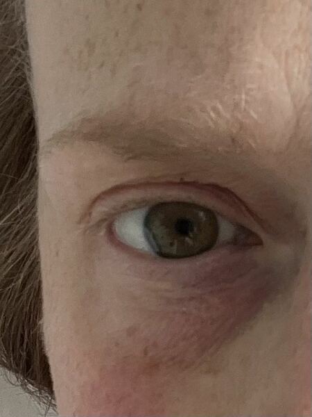 Help! I’m only 46!