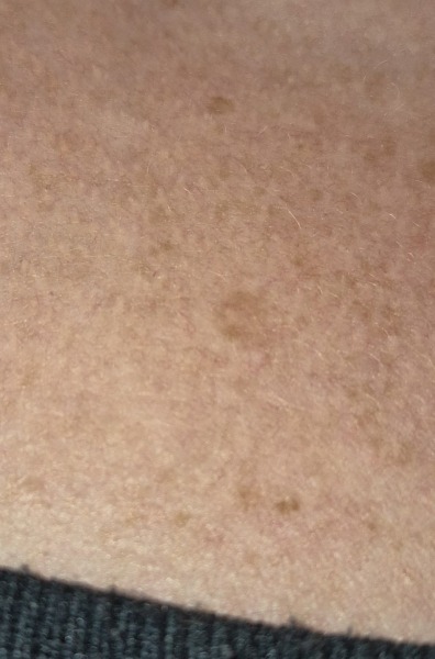 How urgently do I need to get this checked?