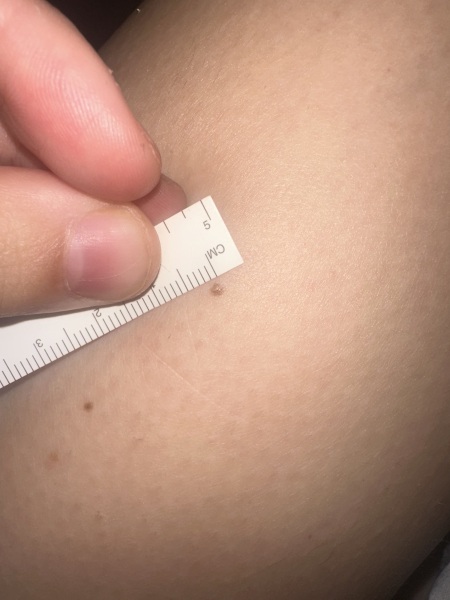 Moles