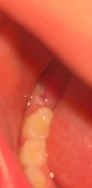 What is this in DD’s mouth.