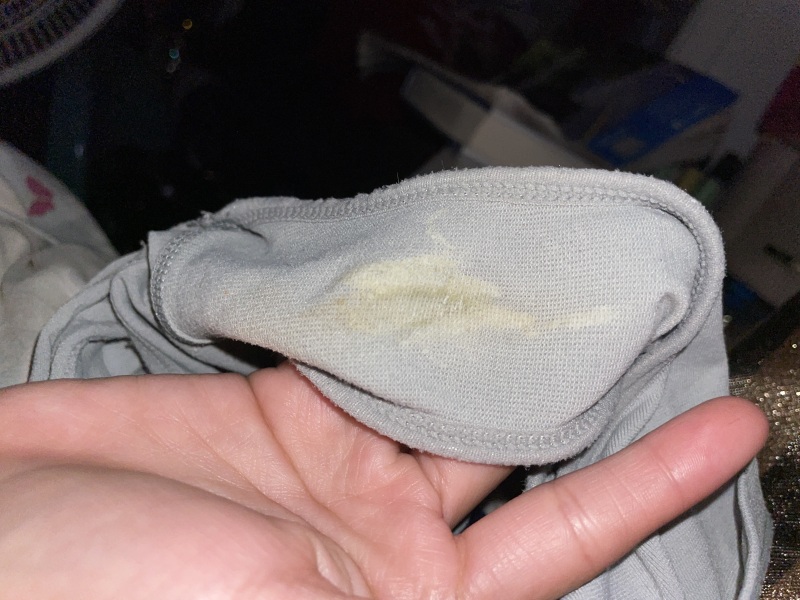 5 weeks pregnant with this discharge this this normal?