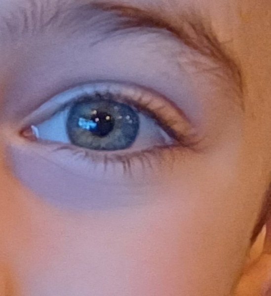 What colour are these eyes?