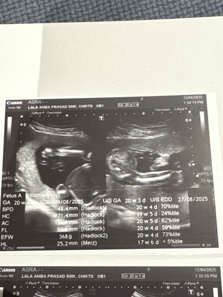 20 week potty shot - boy or girl?