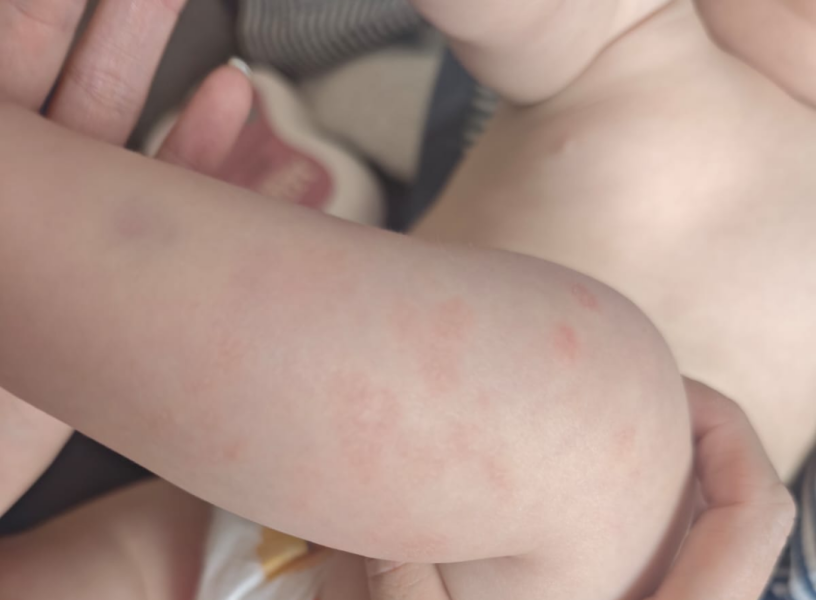 What does this look like to you?