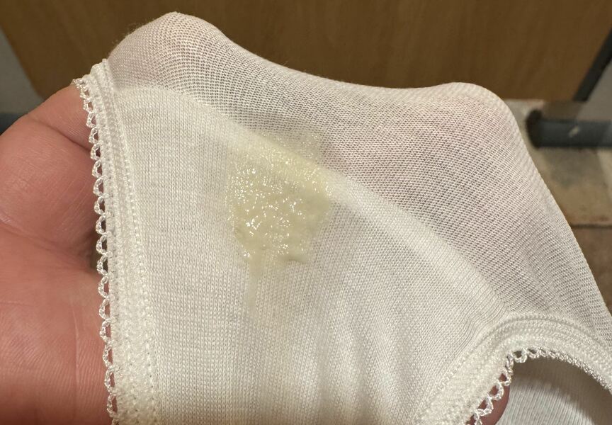 Is this normal discharge ?  Picture below