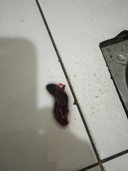 Possible miscarriage? 6 weeks 4 days