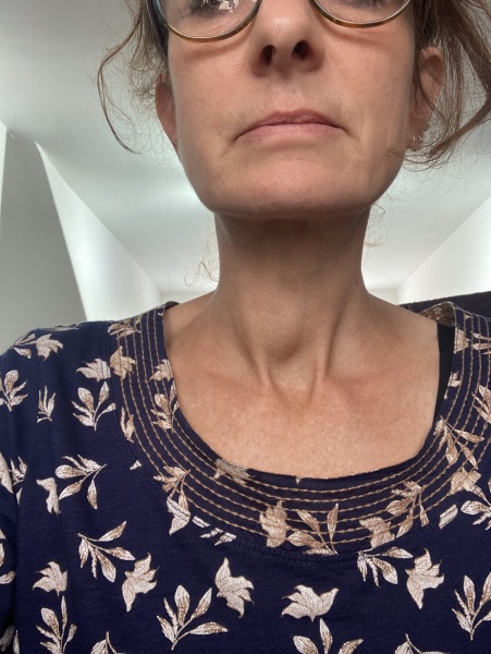 Throat lump