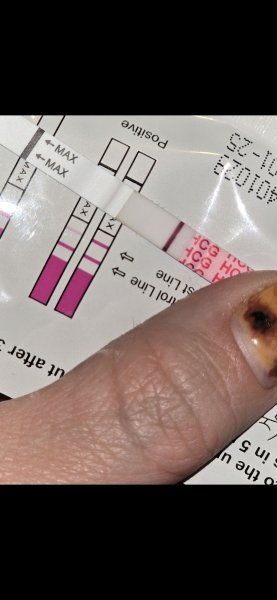 Line eyes - again 👀