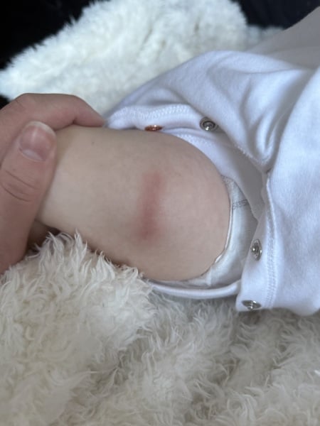 8 week vaccinations red mark