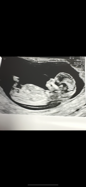 Boy or girl