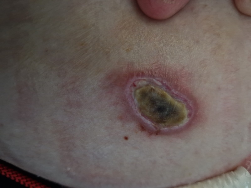 Random raw skin thing - ideas?