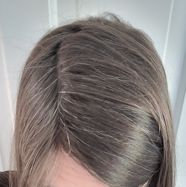 How much grey hair at 40?