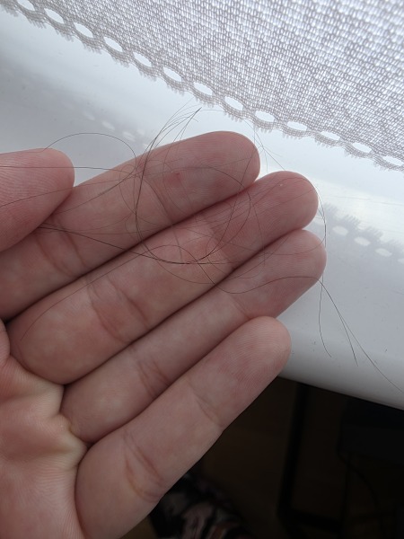 3 year old hair falling out