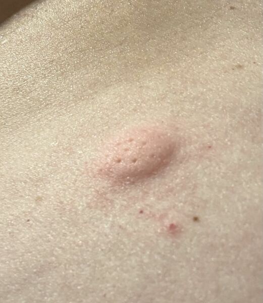 Help -  5th dose
