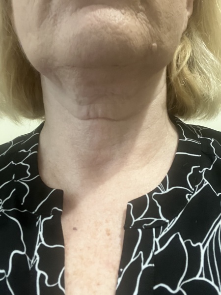 Jan 25 Starters Thread 7 😱 Losing, whooshing, turtle pace - we're getting it done.