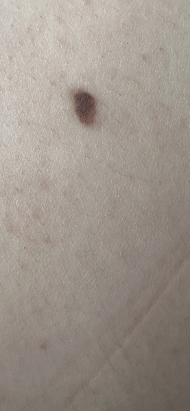 Moles
