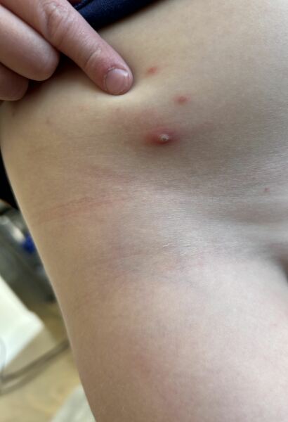 Multiple spots on body