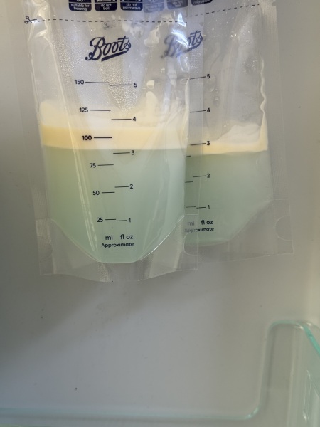 Why is my breast milk blue?