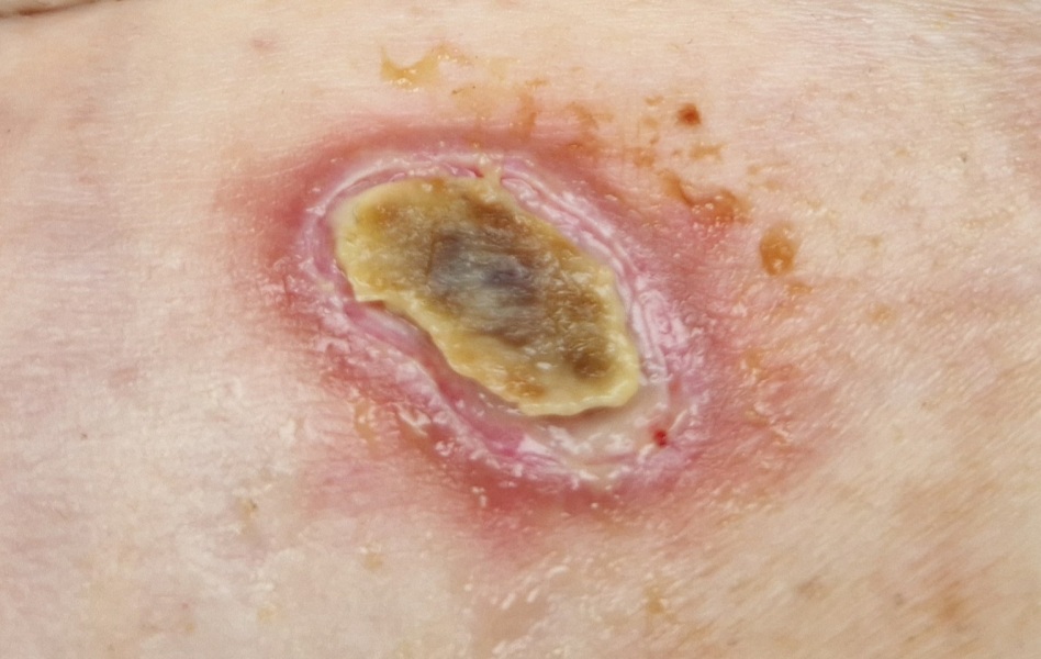 Random raw skin thing - ideas?