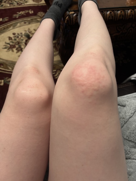 Something on my knees