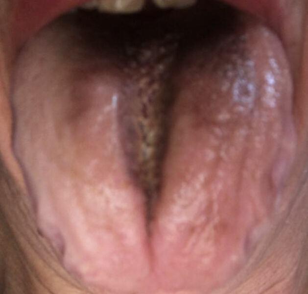 to wonder about my tongue and Dr reply?